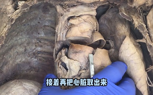 真实的人类胸腔内的结构，以及血管和神经