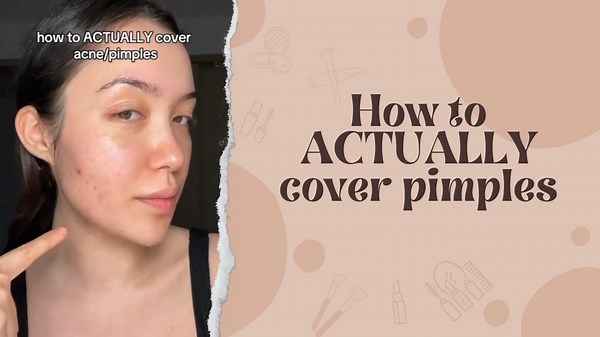 How to Actually Cover Pimples Flawlessly