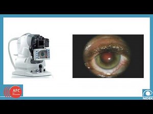 Auto Fundus Camera - Advanced Diagnostic Capabilities