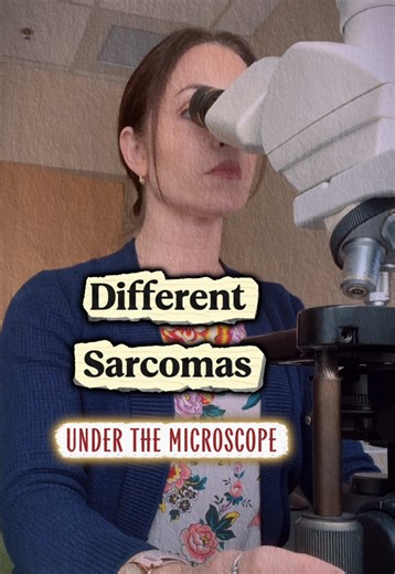 There are more than 70 distinct sarcoma subtypes currently recognized.. ➡️ The sarcomas shown here are a few of the more common subtypes 🔬Sarcomas can be challenging to diagnose on appearance alone, due to overlapping features 🧬 Molecular profiles are especially useful in diagnosing soft tissue and bone sarcomas #sarcoma #cancer #pathology #health #diseases