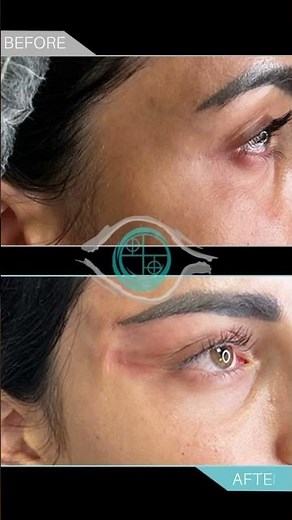 Fox Eyes with PDO threads