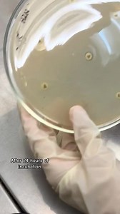 74K views · 960 reactions | Antimicrobial susceptibility testing ♥️♥️ #lablife #microbiology #diagnosis | Lab life | Facebook