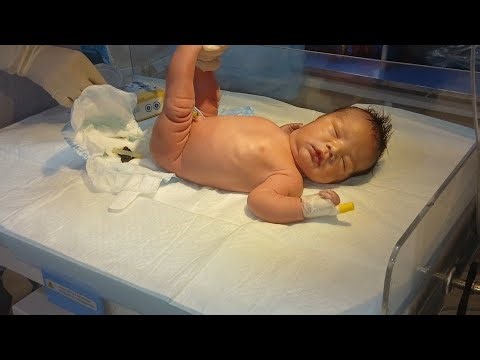 Newborn Not Passing Meconium | Excessive Crying Relieved After Rectal Suppository (Educational)