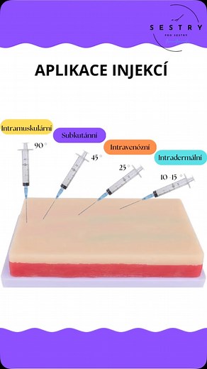 Od sestry pro sestry on Instagram: "💉Aplikace injekcí je zdravotnický postup, při kterém se léčivá látka vpravuje do těla pomocí injekční stříkačky a jehly. Existuje několik typů injekcí, které se liší místem aplikace a účelem podání. Typy injekcí: ➡️Intramuskulární (i.m.) injekce: * Aplikace do svalu. * Vhodné pro podání léků, které se vstřebávají pomaleji. * Nejčastěji se aplikují do hýžďového svalu, stehenního svalu nebo deltového svalu. ➡️Subkutánní (s.c.) injekce: * Aplikace do podkoží. * 