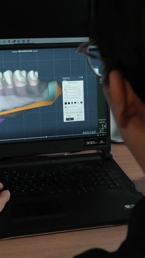 AI-Powered Growth Partner for Digital Dentists & Labs on Instagram: "Designing full-arch or implant cases in Exocad? 🧑🏻‍🎨🦷 Follow this simple hack to save time while protecting anterior esthetics and posterior occlusion.💯 #digitaldentistry #dentalcad #dentalcaddesign #cadcam"