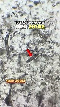 The mites that live on your face 🔬 #foryou #science #microscope #demodex