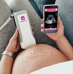 How cool is this new technology? Make your own ultrasounds at home! 🏠 | Baby-Scan