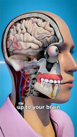 “What Happens Inside a Tooth Infection? 😱 (Animation)”