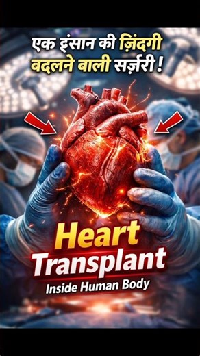 Inside the Heart Transplant Surgery ❤️ | Doctors Are Replacing a Human Heart – Step by Step Surgery