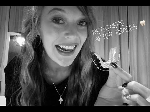 Retainers after braces