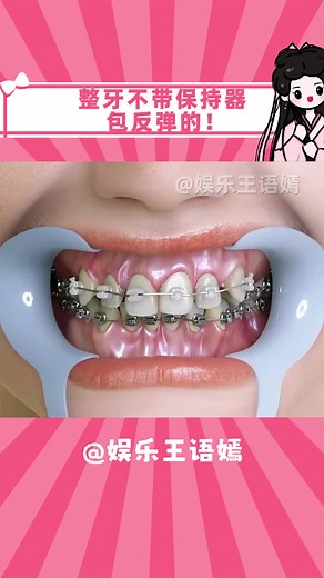 整牙過程中的保持器重要性