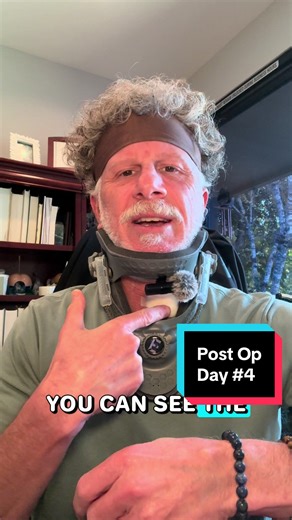 TushyDoc Neck surgery. Cervical disc replacement day 4 #cervicaldisc #pain #neckpain #necksurgery #neuralgia
