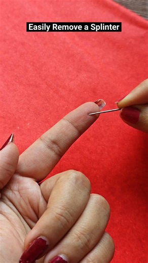 "Easy to remove Splinter"🤯😳😍#howto #tipsandtricks #lifehack #home