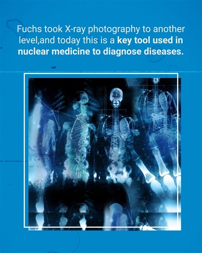 On this day in 1934 the first full-body X-ray photograph in colour was taken in a one-second exposure by Arthur Fuchs while working at the Eastman Kodak Company. Fuchs and his colleagues developed a shield that had different densities that could let more X-rays pass through the thicker parts of the body, while allowing less for the thinner areas like the arms and legs. If the shield had a uniform density, they would not have a clear image as thinner areas of the body would be more washed out fro