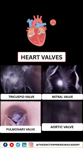 Excellent video showing how the 💓 heart valves work in harmony! these valves 🩺 ensure that blood 🩸 flows in only one direction — keeping your circulation efficient and your heart healthy. 🫀 the human heart has four valves: 🔹 tricuspid (right atrium ➡️ right ventricle) 🔹 pulmonary (right ventricle ➡️ lungs) 🔹 mitral (left atrium ➡️ left ventricle) 🔹 aortic (left ventricle ➡️ body) watch it, learn it, love your heart! 💗 #medstudentlife #cardiophysiology #heartvalves #mbbsnotes #doctorjour
