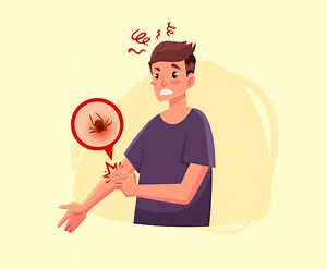 Comment enlever une tique sur l'homme et éviter Lyme ?