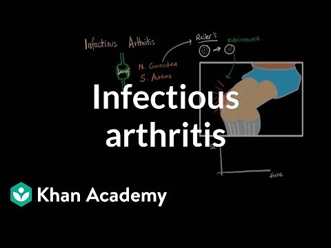Infectious arthritis | Muscular-skeletal diseases | NCLEX-RN | Khan Academy