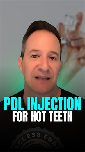 Dr. Rinesh Ganatra | Dental Practice Mastery on Instagram: "The PDL injection is really important when lidocaine doesn’t fully numb the tooth. Even if the lip and tongue are numb, always retest for cold or percussion sensitivity. Bevel should face the bone, not the root, for direct delivery into the cribriform plate. Look for blanching at all four line angles, then retest to confirm if you're good to go. WANT TO LEARN MORE? Comment ENDO and I'll send you @drbrettgilbert Access Endo FREE training