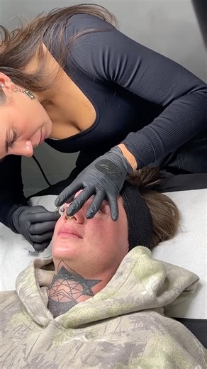 COS | SKIN SPECIALIST on Instagram: "Your sign to get dermaplaned ✨ Dermaplaning is next-level exfoliation — it gently removes dead skin + built-up debris sitting on the surface so your skin can actually breathe again. Instantly smoother, brighter, and glowier… and yes, you get to SEE everything that comes off 👀 (oddly satisfying + proof it was needed) Smooth makeup. Better product absorption. That glass-skin feel. Book your dermaplane & let your skin shed what it’s been holding onto"
