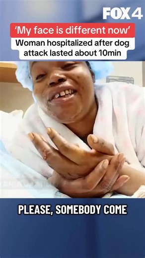 On the morning of Jan. 7, Toni Hudson’s life changed forever. “I’m different. Now, you know, my face is different, my walk is different, the way I move is different,” Hudson said. “My kids and them try to cheer them up, but they see me, and they just cry. You know what? I mean? It’s hard.” Hudson said she was walking down Marfa Avenue when a neighbor’s pit bill attacked her. “The dog was already trying to chase somebody else, and it turned around, and it grabbed my leg and it shook me down,” Hud