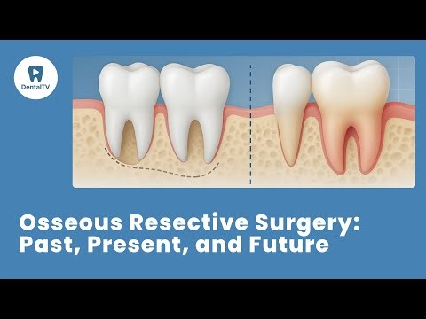 Osseous Resective Surgery: the past, the present and the future