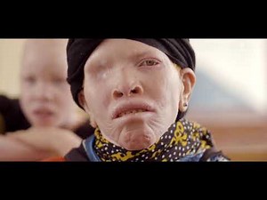 Protégeons les personnes atteintes d'albinisme / Fondation Pierre Fabre