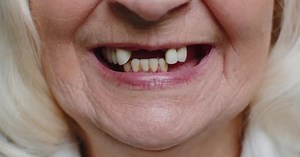 Closeup Macro of Toothless Smile Mouth of Female Senior Woman Dental Problem Bad Teeth Loss