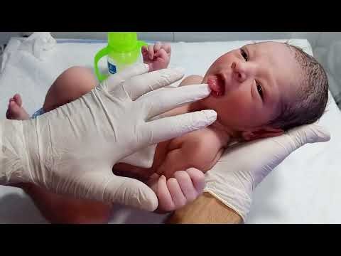 ENNS Baby NICU Care | Recovery, Management & Starting Feeding (Good Condition)