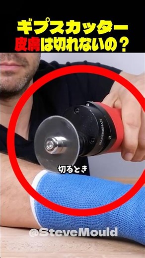 骨折時にお世話になる画期的な技術
