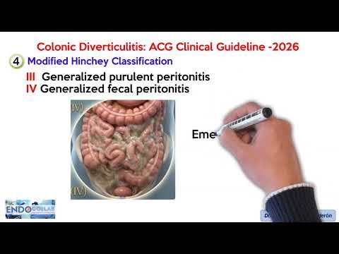 Colonic Diverticulitis: ACG Clinical Guideline - 2026