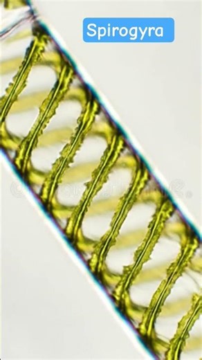 structure of spirogyra #microbiology #shortsviral #experiment #biology #botony #spirogyra#botony #yt