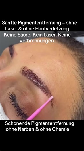 Sanfte Pigmententfernung für Tattoos & PMU