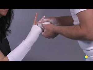 Dorsopalmer (ulnar gutter) short arm splint(slab) using plaster of paris