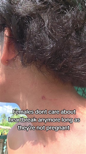 @Spooki👻 Mc #blowthisup #carribeantiktok🇺🇸🇹🇹🇸🇷🇰🇳🇱🇨🇻🇨🇯🇲🇬🇾🇨🇦🇦🇬 #Whiterice #spookie #guyana🇬🇾