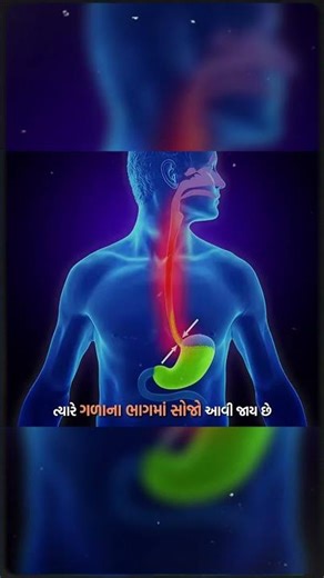 Do you often feel like vomiting or a burning sensation in your throat? It might be Acid Reflux. ⚠️