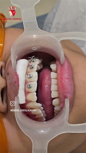 Modern Orthodontics Starts with Pitts 21!