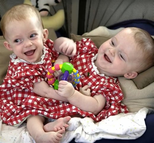 Doctors performed a life-changing surgery to separate conjoined twins — here’s how they look 25 years later See less Doctors performed a life-changing surgery to separate conjoined twins — here’s how they look 25 years later Back in 2000, twin sisters were born joined from the chest down to the pelvis. They had two torsos but shared several vital organs 😱. When they were just seven months old, surgeons took on the challenge of separating them. After a grueling 31-hour operation, the procedure w