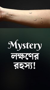 1.4K views · 24 reactions | রহস্যময় লক্ষণ ! Mysterious Symptoms - Formication #homeopathy #treatment #patient #medicine #peculiar #symptoms #mystery | HomeoExpress | Facebook