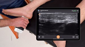 Plantar Fasciitis | Clarius