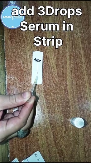 Syphilis VDRL Test Full Procedure #laboratory #smartphone#labchannel #trending #hematology #unboxing