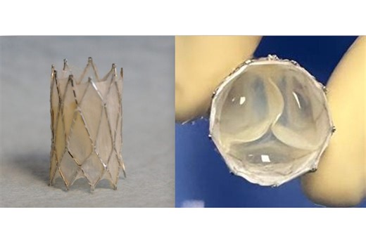 Heart Valve Developed at UC Irvine Shines in Early-Stage Preclinical Testing