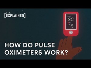 How pulse oximeters work, and why they sometimes do not