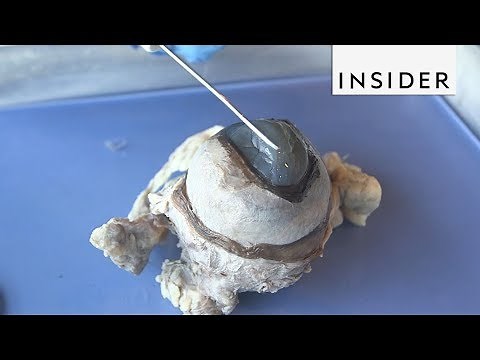 Learning About Vision Through Cow Eye Dissections