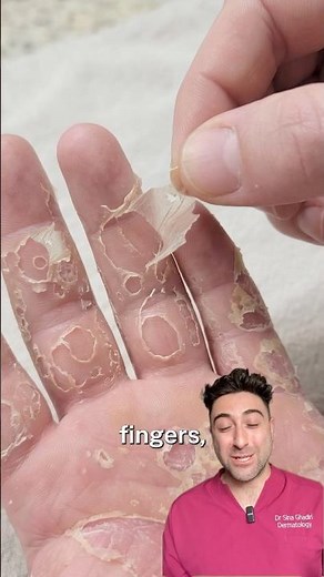 When you realised this wasn’t eczema…