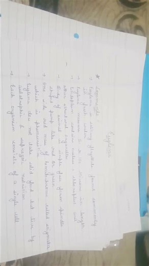 #Euglena ## protozoan# invertebrates animals ##