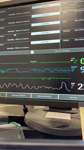 Patient presents after passing out during PT. Patient then goes on monitor to be in a complete heart block which then turns into this. 13 seconds of asystole. Patient wakes uo and continues the conversation she was having before. #asytole #telemetry #nursing #telemetrynurse “#ernurse #cardiac #nurse #cardiacnurse
