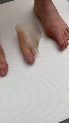 #protesedemm #protese #protesedesilicone #protesedemmii