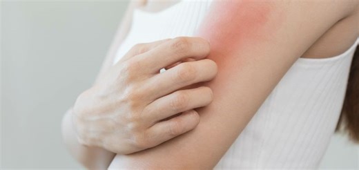 Conozca las causas y tipos de dermatitis; una enfermedad más común de los que se cree