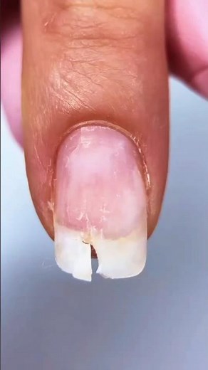 Wait… don’t cut it! 😳💅 Watch this cracked nail get FIXED in seconds!