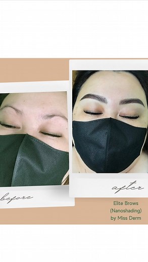 166 reactions · 74 comments | The magic of nanoblading + shading! This PMU technique is what everyone's asking due to its adaptability to different skin types and ages. PM us to know more. Branches: Las Piñas, Makati & Quezon City | Miss Derm | Facebook